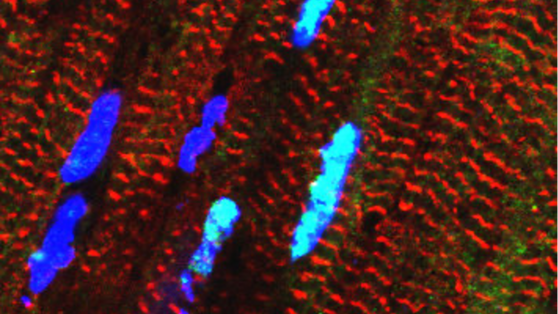 © Michael Radke, Max Delbrück Center