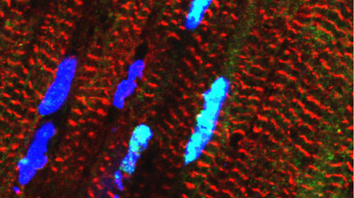 © Michael Radke, Max Delbrück Center
